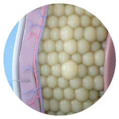 Image showing fat cells before CoolSculpting.