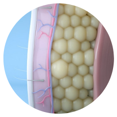 Image showing after CoolSculpting results of fat reduction.