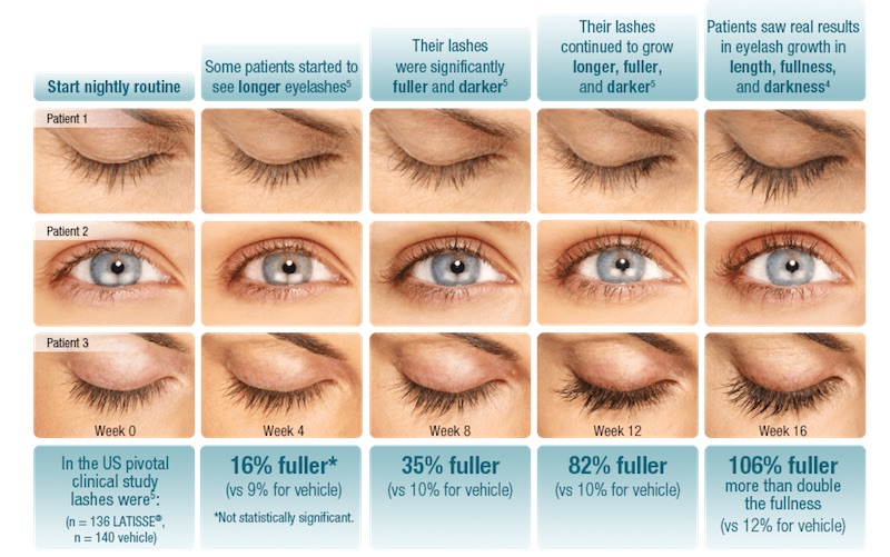 Graphic shows the transition of 106% growth over 16 weeks for fuller lashes from Latisse.