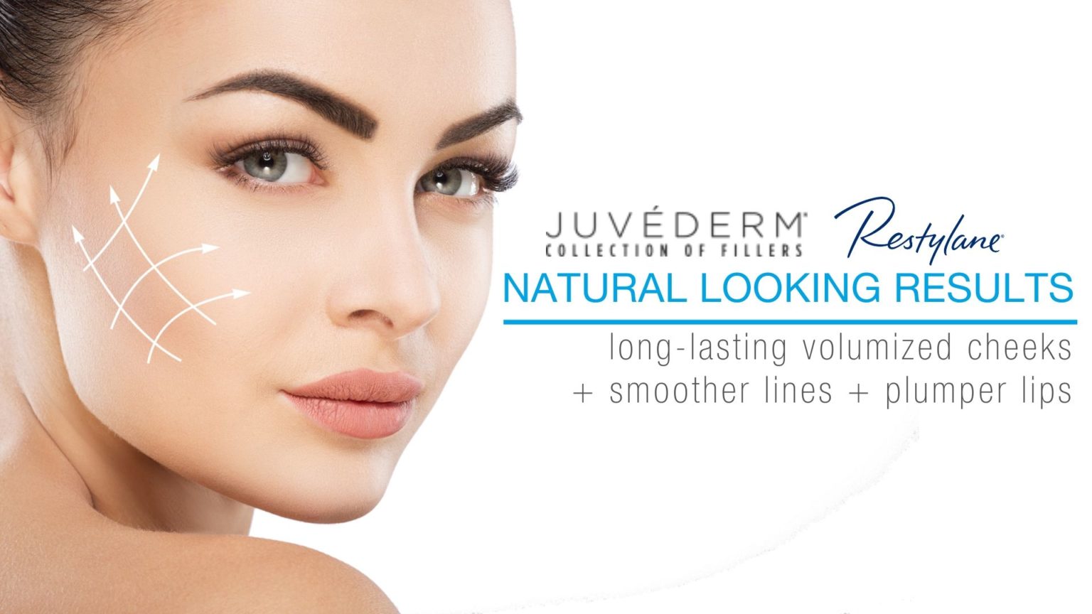 Juvederm Fillers at Laser + Skin Institute Chatam, New Jersey