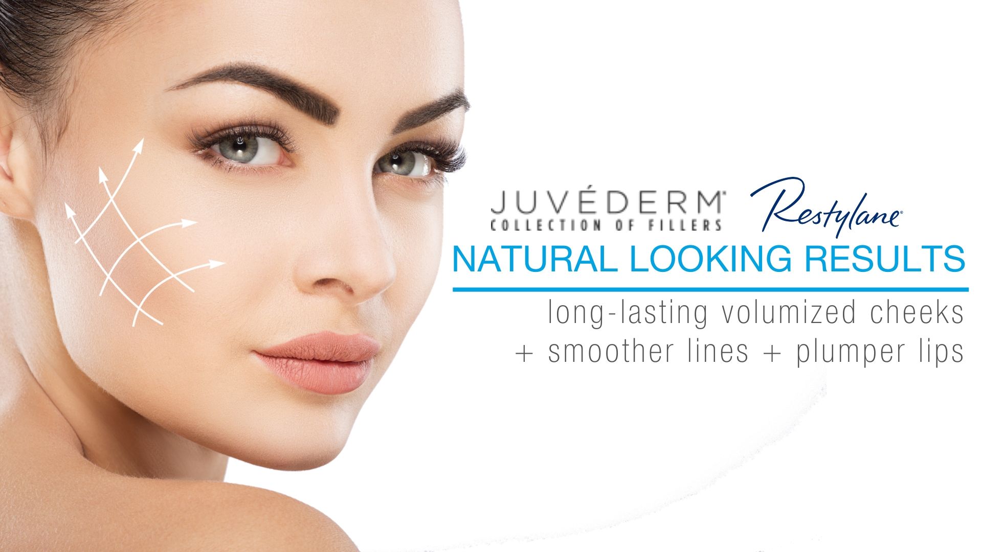 Woman with dermal filler, juvederm restalyne.