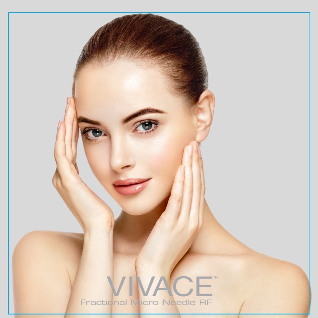 Vivace RF Microneedling