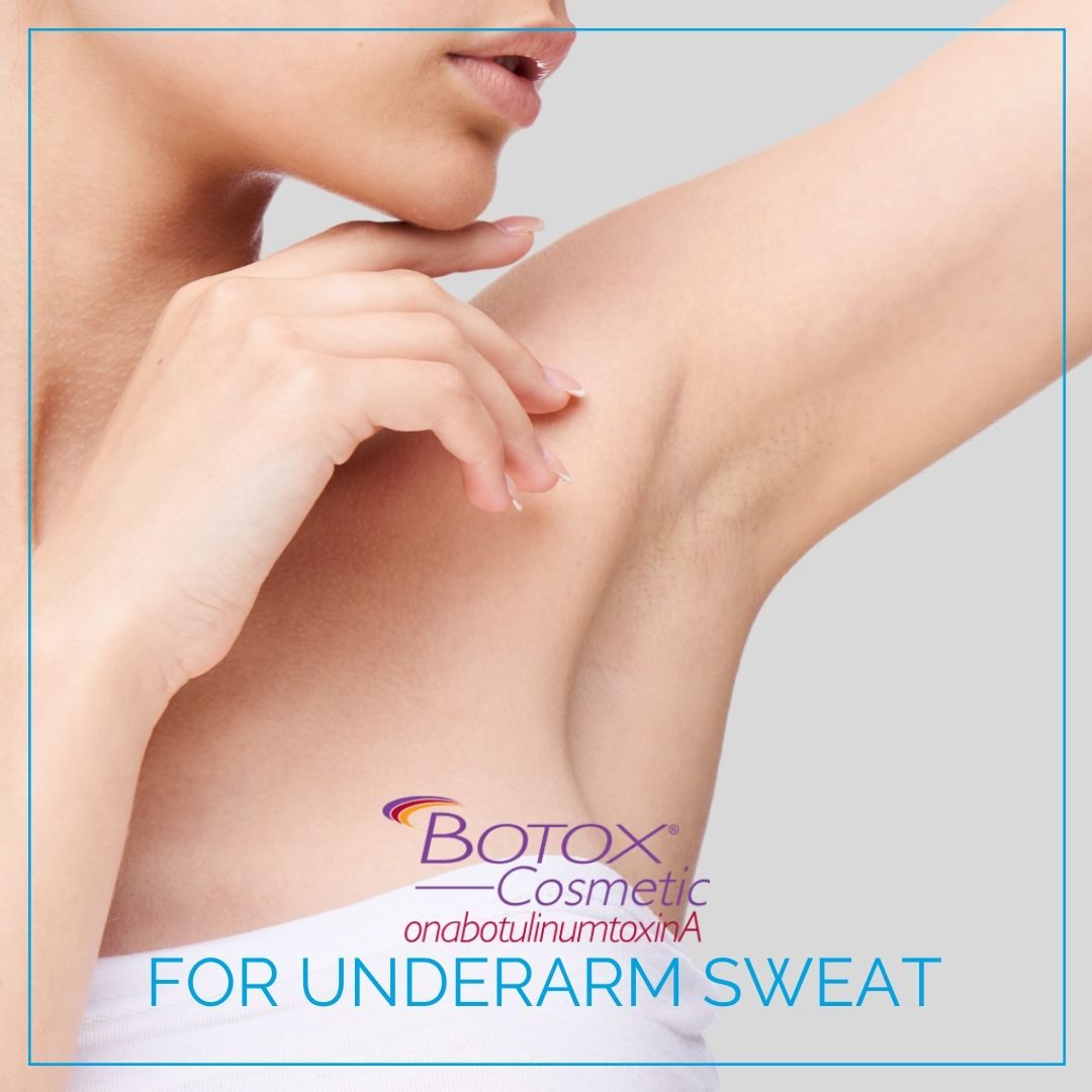 Botox hyperhidrosis: for underarm sweat.