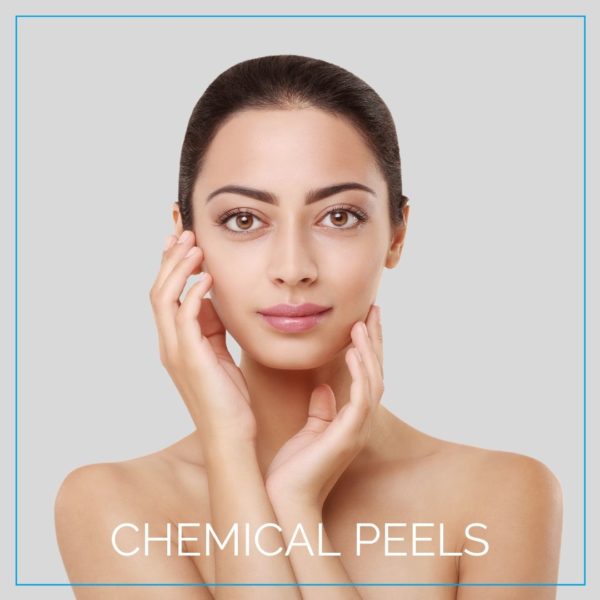 Chemical peels.